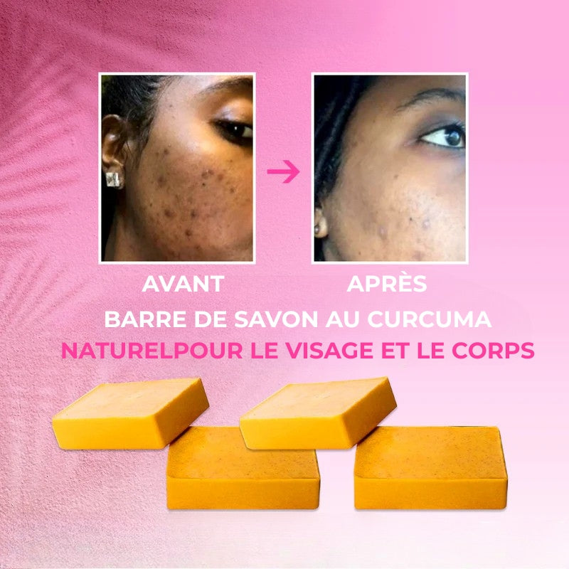 GlowTurm™ – Savon Eclaircissant